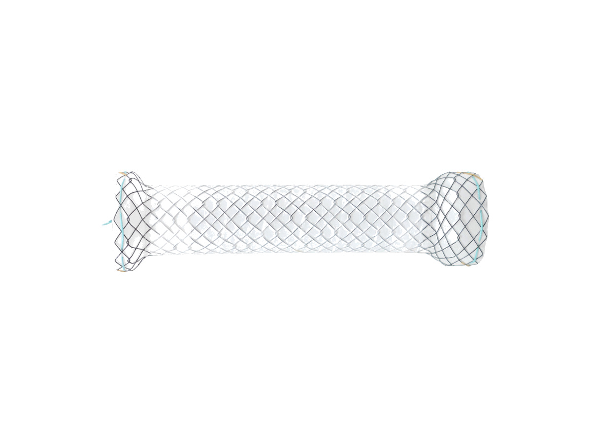 Hilzo™ UES Esophageal Stent